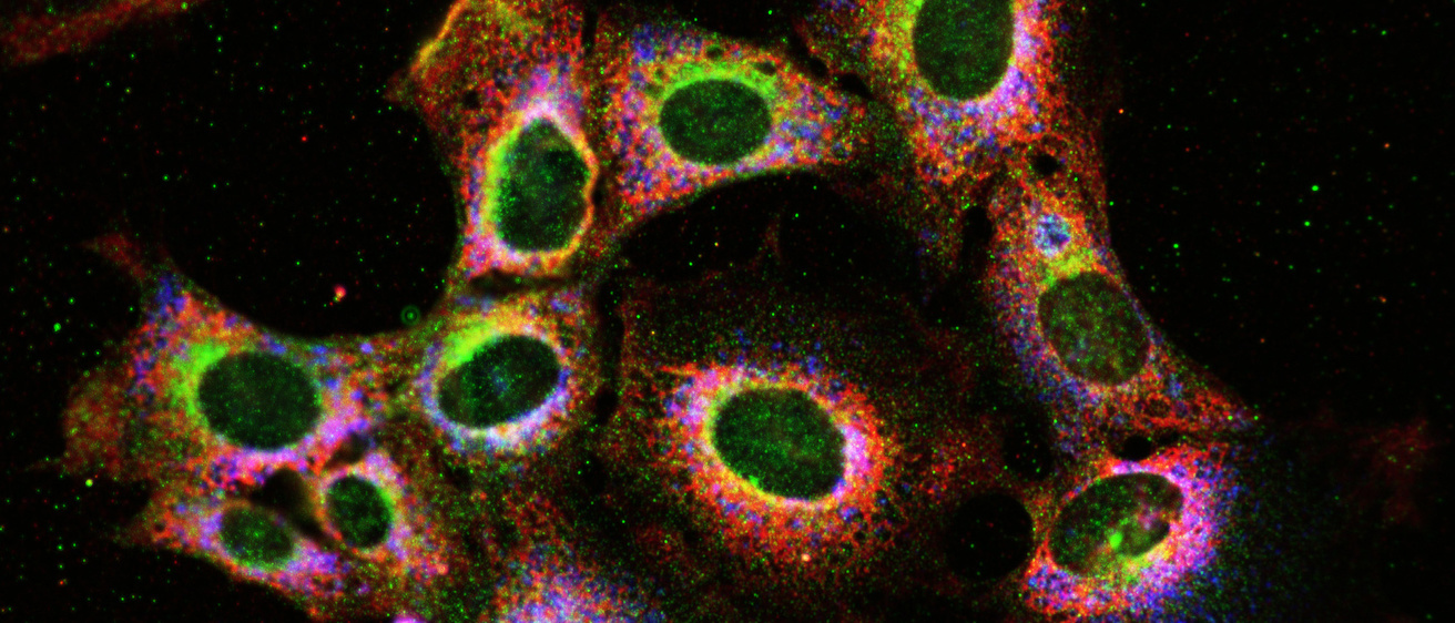 Microscopy image of mefl10 NPC1 cell